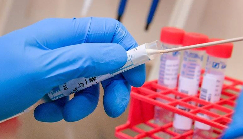 Nigerian entrepreneurs get £5,000 funding for innovative ideas on COVID-19 COVID-19 Test kit
